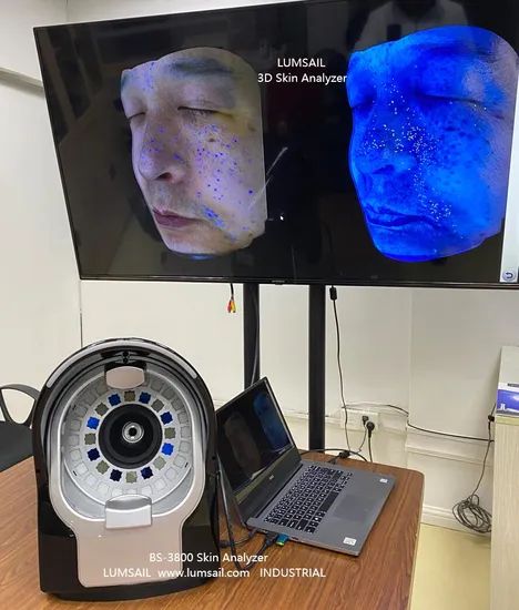Analyzer Skin Facial Analysis Skin Monitor Analyzer Skin Detector 3D Digital Skin Analyzer Machine - Image 4