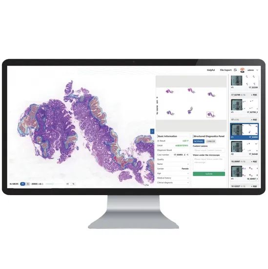 Pathology Ai System Medical Equipment Medical Instrument Group All Origin China Certification CE Trademark Gmedisys Application2 - Image 5