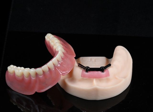Digital Full Denture China Digital Dental Lab - Image 3