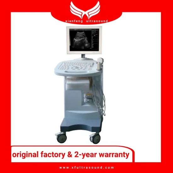 Trolley Black and White Ultrasound Machines Medical Equipments - Image 1