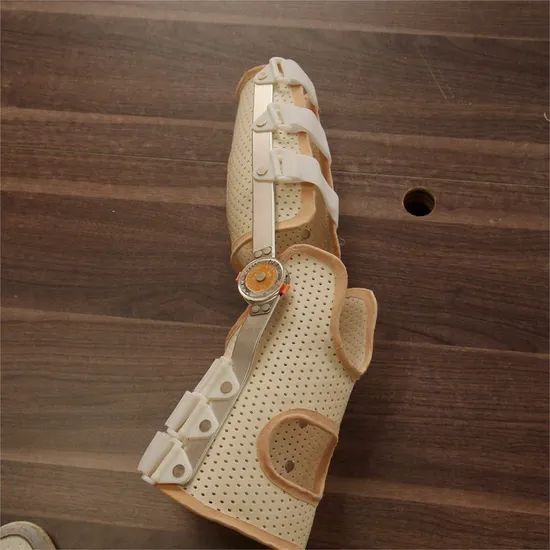 Physiotherpy Splints Thermoplastic Orthopedic Splint for Physiotherapy Fracture ...