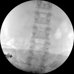 Stationary X-ray System LG-Plx118 High Frequency Digital Radiography System - Image 6