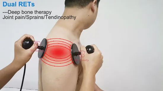 Newest Tecar RF Equipment Physical Therapy Physio 10.0 448kHz Tecar for Pain Relieving - Image 4