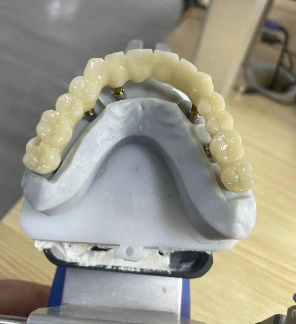 Dental Lab Factory in China OEM Dental Lab Manufacturer from China - Image 2