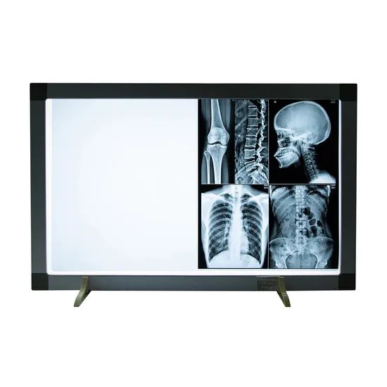 Pvc Radiography Precision Clear Imaging Money-Saving Medical Dry Radiography X Ray PVC ...