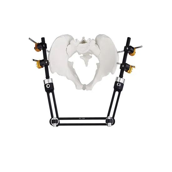 Surgical Instruments Orthopedic Fixation Pelvic External Fixator - Image 2