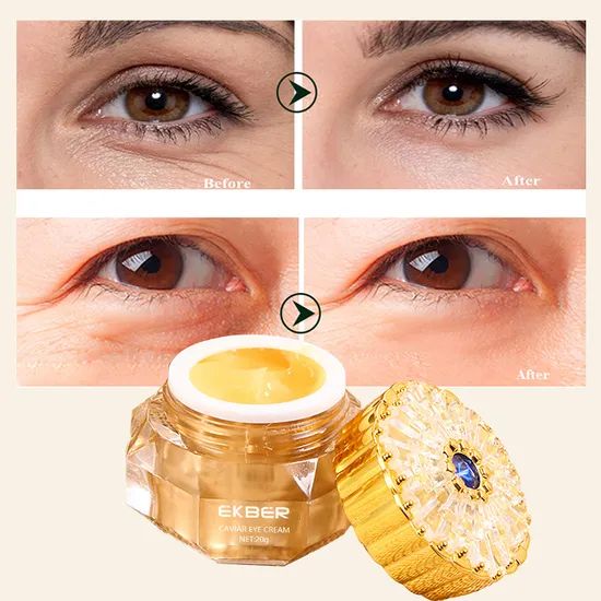 Organic Under Eye Cream Dark Circles Puffy Eye Bags Removal Caviar Moisturizing Tender Xanthan Gum Eye Cream - Image 4