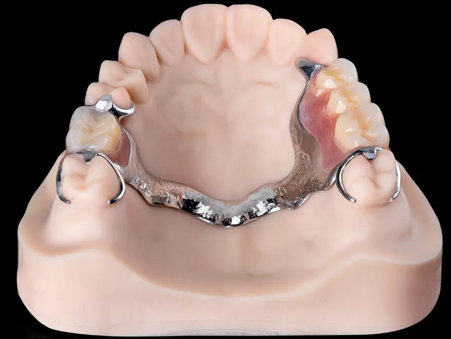Digital Full Denture China Digital Dental Lab - Image 4
