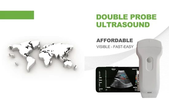 Compact Ultrasound Equipment for Veterinary and Human Use Trademark UMY Brand Name Umy Warranty 1 Year Origin Guangzhou Shelf Life - Image 4