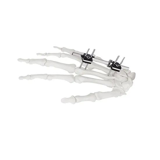 Surgical Instruments Orthopedic Fixation Pelvic External Fixator - Image 6
