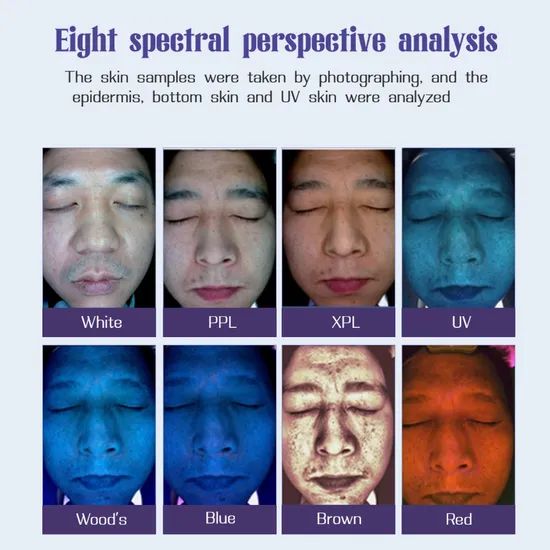 Compact Skin Analyzer Home and SPA Use Wrinkle and Collagen Level Testing - Image 6