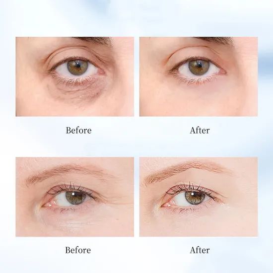 Ditong Ball Essence Eye Cream - Image 6
