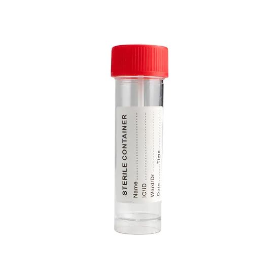 Laboratory Urine Specimen Cups Multi 30ml Urine Test Cup Stool Container with Label - Image 2
