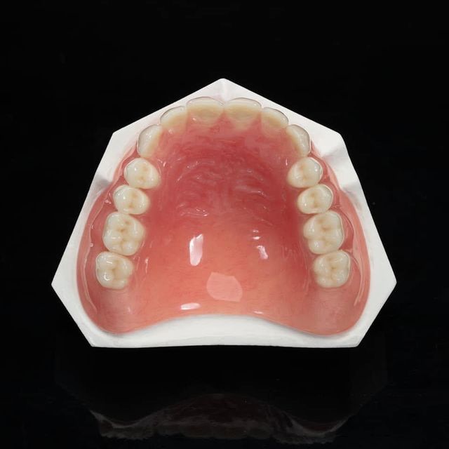 Custom Dental Implant Bridge Zirconia Crowns Screwed Retained Full Arch Cheapest Lab China - Image 3