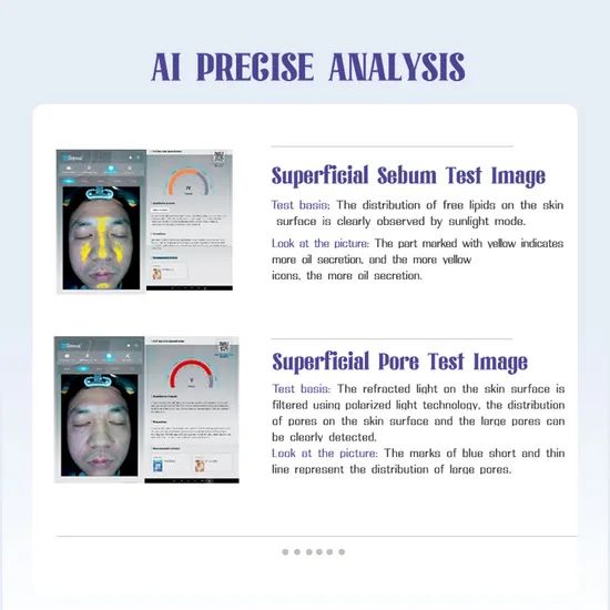 Wireless Skin Analyzer for Professionals Real-Time Skin Data Transmission - Image 3