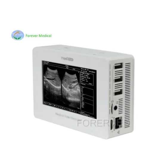 Portable HD 1080P Integrated Endoscope Camera Ent Unit HD Recorder - Image 2