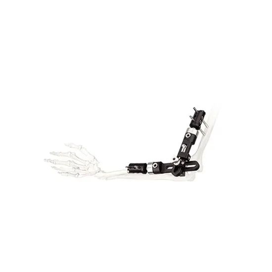 Surgical Instruments Orthopedic Fixation Pelvic External Fixator - Image 4