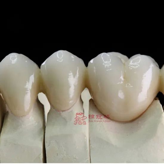 Customized Remote All Ceramic Teeth Supports Browsing Files in Various Formats Stl Ply Dcm Impression Model - Image 3