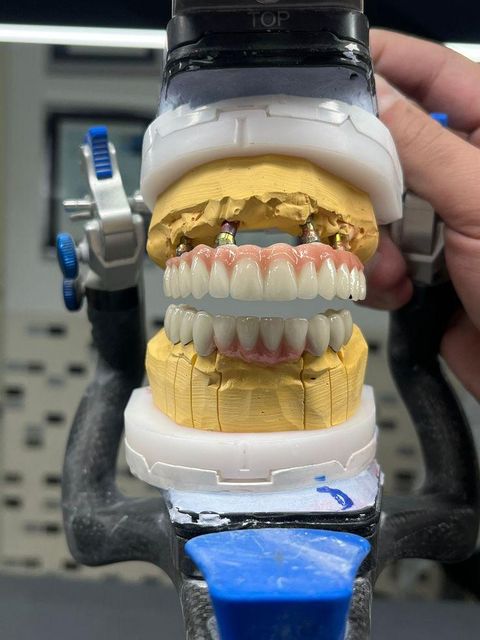 ShenZhen China Implant Dental Factory Custom Metal Ceramic Zirconia Crown and Bridges Good Price - Image 3