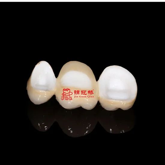 Customized Remote All Ceramic Teeth Supports Browsing Files in Various Formats Stl Ply Dcm Impression Model - Image 4