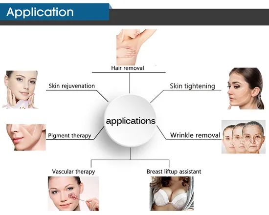 IPL Machine Beauty Equipment Hair Removal - Image 6