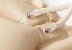 Medical Anti Decubitus Mattress Ripple Mattress with Pump - Image 6