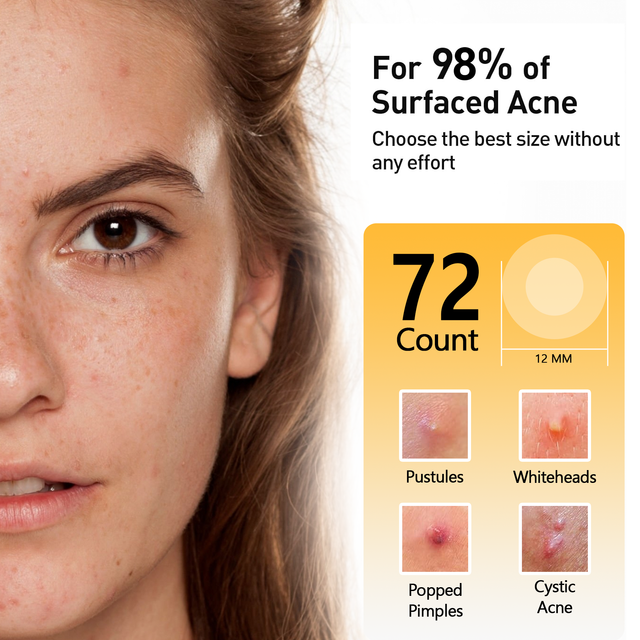 CanVita Pimple Patches - 72 Dots of Effective Solution for acne and pimples , tea tree oil and salicylic acid - Image 4