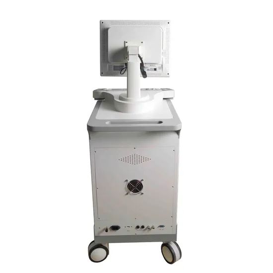Trolley Black and White Ultrasound Machines Medical Equipments - Image 5