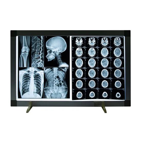 Pvc Radiography Precision Clear Imaging Money-Saving Medical Dry Radiography X Ray PVC ...