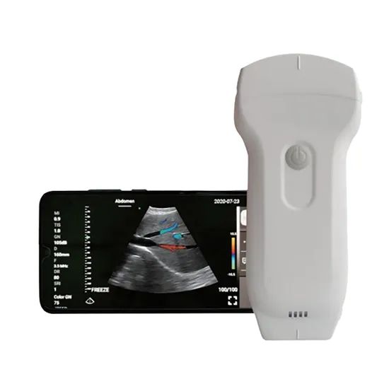 Compact Ultrasound Equipment for Veterinary and Human Use Trademark UMY Brand Name Umy Warranty 1 Year Origin Guangzhou Shelf Life - Image 3