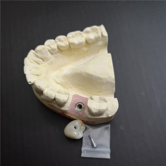 Dental Lab Direct Digital Full Denture China Dental Outsourcing - Image 3