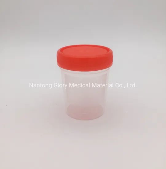 Premium Plastic Specimen Containers for Urine and Stool Samples - Image 6
