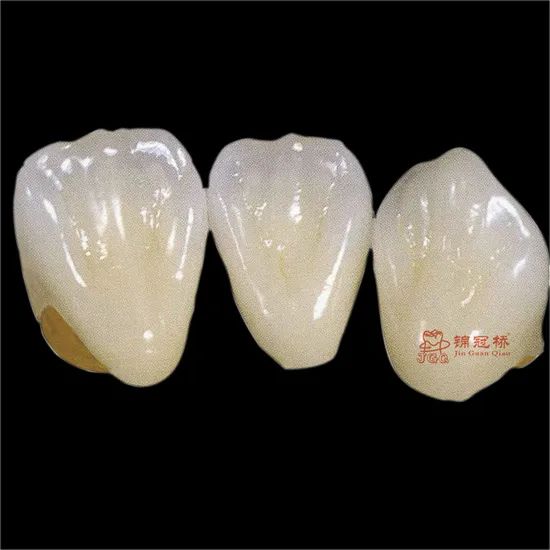 Customized Remote All Ceramic Teeth Supports Browsing Files in Various Formats Stl Ply Dcm Impression Model - Image 5