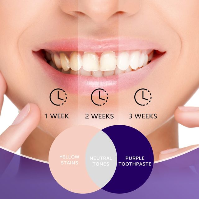 Wholesale Teeth Whitening Toothpaste 30ml Purple Teeth Whitening Toothpaste Private Label - Image 3